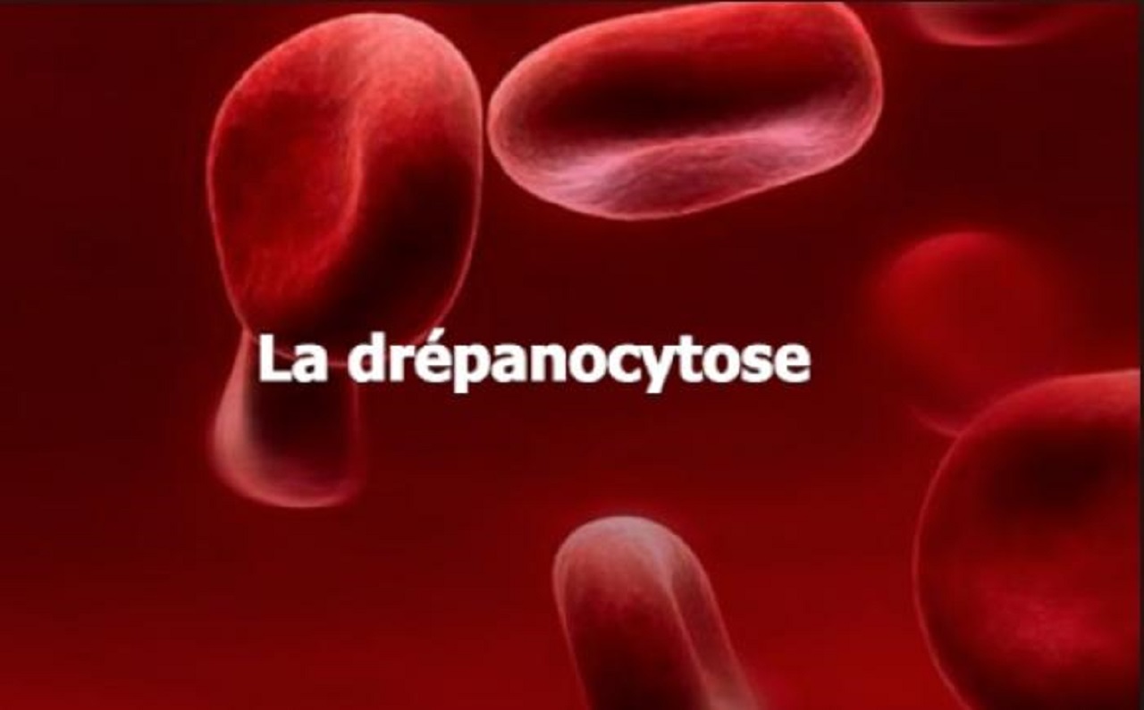 Togo- Santé publique : les «Rencontres sur la drépanocytose» du 17 au 20 juin à Lomé et Kpalimé
